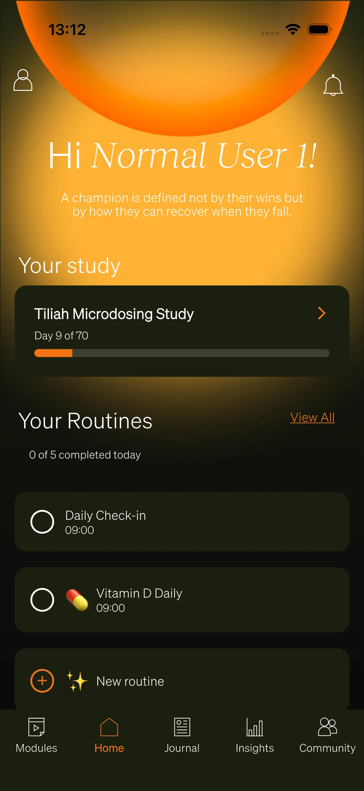 The Home tab showing the “Your study” card with day progress.